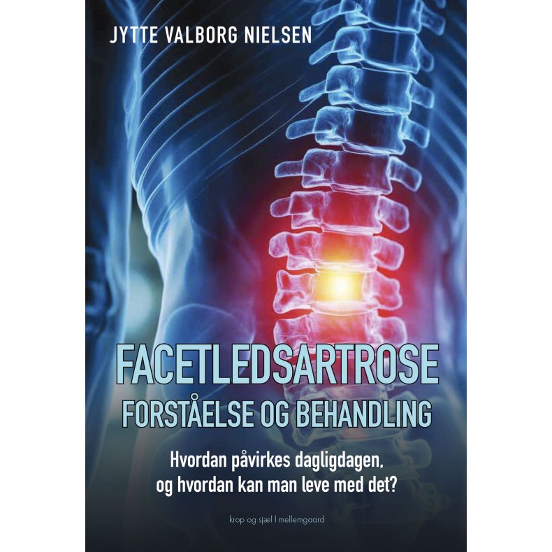 FACETLEDSARTROSE - FORST�ELSE OG BEHANDLING. Hvordan p�virkes dagligdagen, og hvordan kan man leve med det?