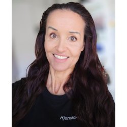 OVERGANGSALDEREN - Kosttilskud eller hormoner?